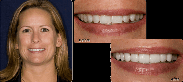 Kelly Blair Cosmetic and Restorative Dentistry