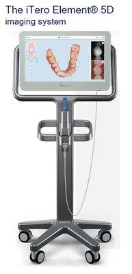 Itero, 3D scanner for Invisalign treatment, & other.