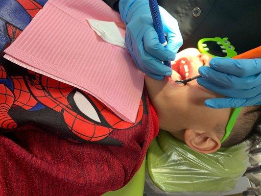 Aaron's first teeth cleaning