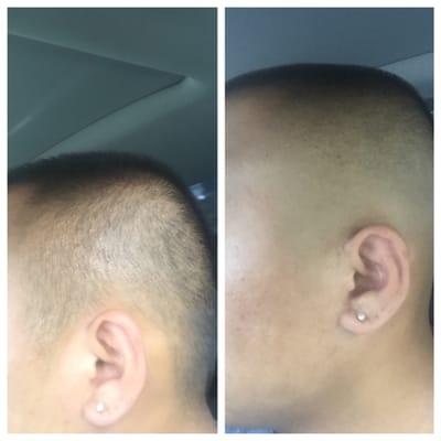 Before and after lol zero fade $8