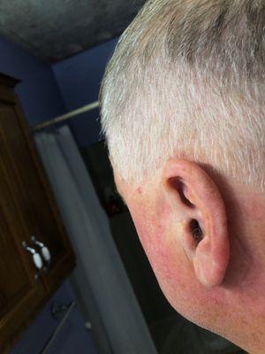 Length of hair at left ear and untrimmed ear hair