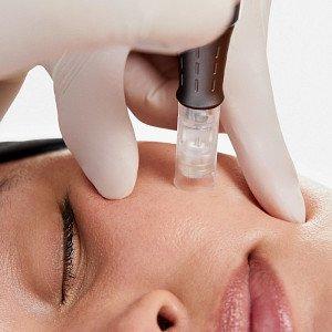 Nano Needling gets products deeper into the skin for even better results!