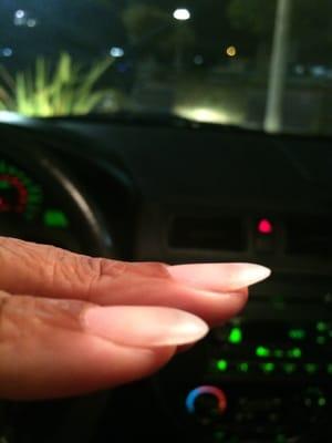 Thin, uneven, misshapen nails.