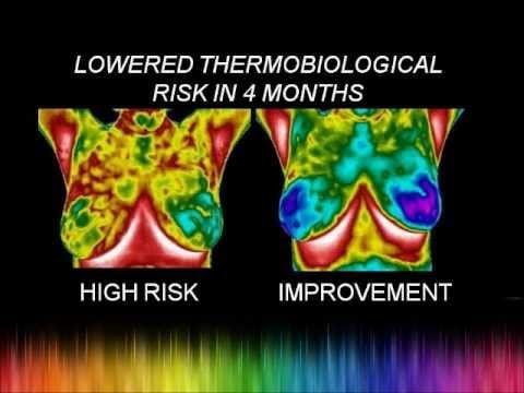 We refer out for thermography to a local office