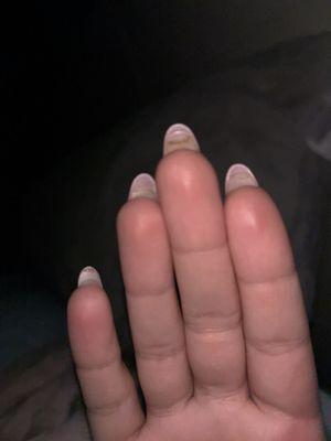 real nails grown out underneath with dirt not removed