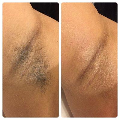 Underarm Wax. Beyond Beauty Boutique loves the Skin Your in!