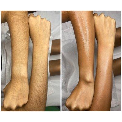 Full arm sugar wax