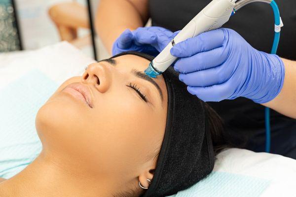 HydraFacial Exfoliating Treatment