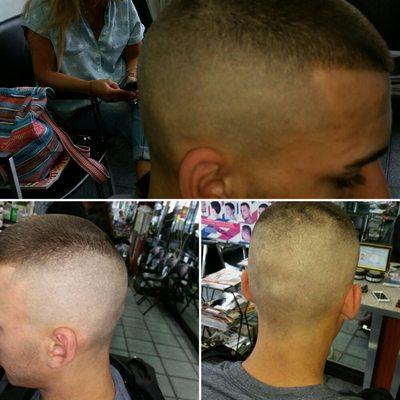 Skin fade