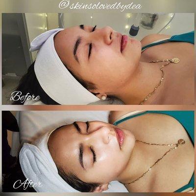 Hawaiian Glow Facial