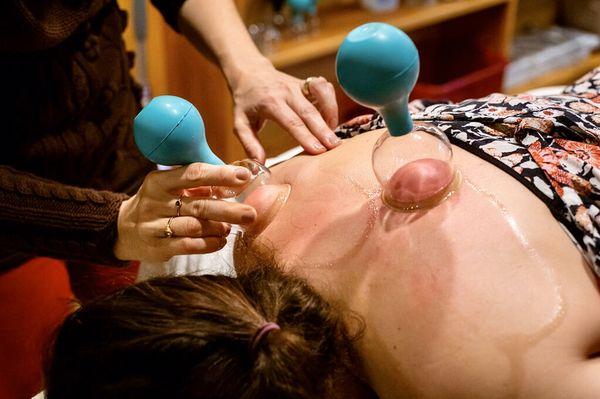 Moving Cupping