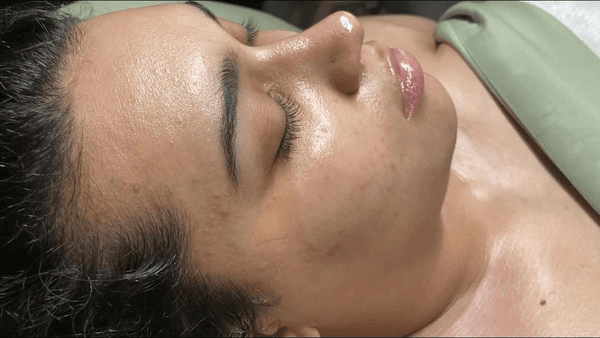 The Unwind Facial after GLOW is real!