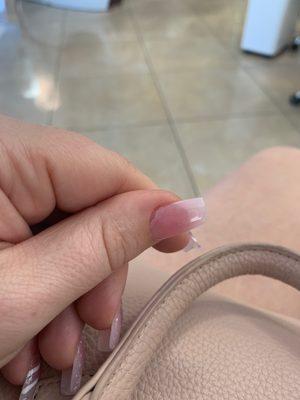 Lifted nail