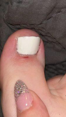 My toe is cut