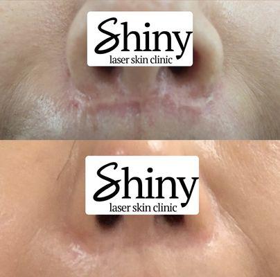 Shiny Laser Skin Clinic