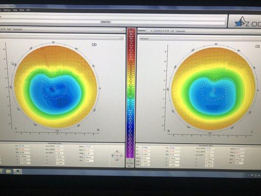 New View Optometric Center