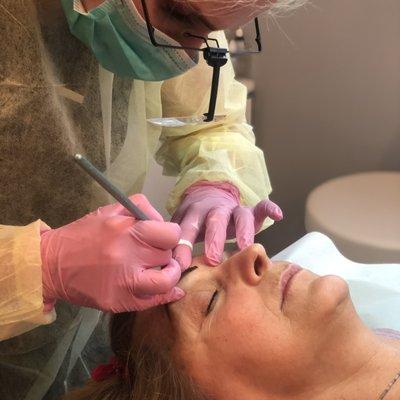 Microblading