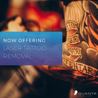 Remove unwanted tattoos with the Pico Discovery laser!