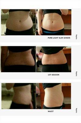 Pure light slim body treatment