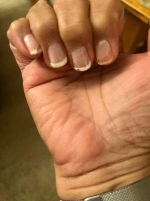 Gel nail manicure after 5 days