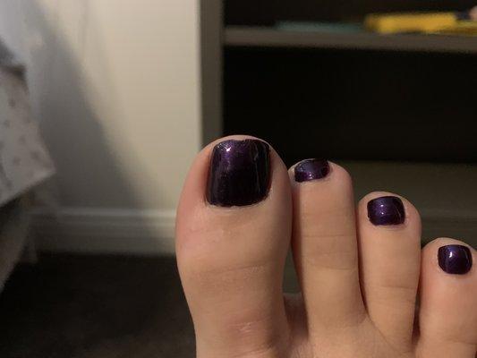 Smudged big toe