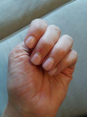 chipped polish 6 days post (only showered, no cleaning or other events that would cause this).  cuticles where not trimmed well.