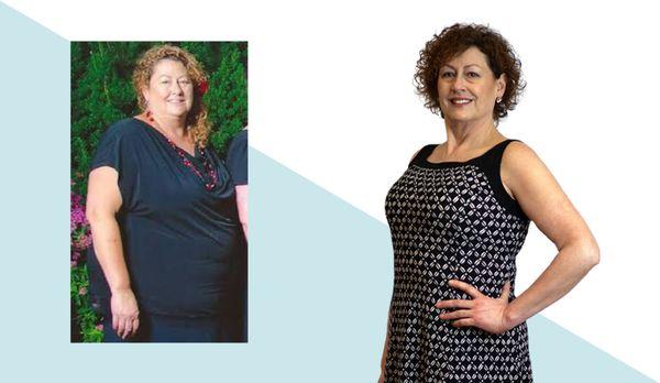 Donalee lost 130 lbs