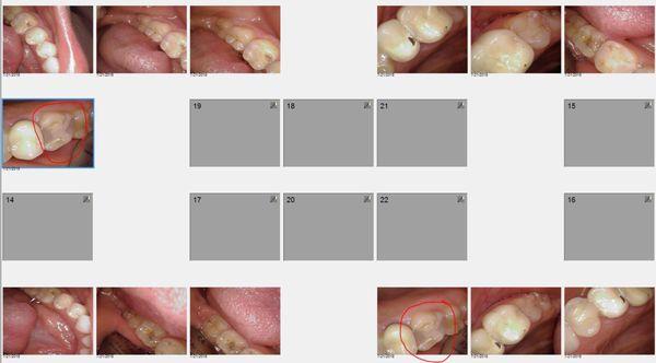 Did work on my front teeth, while leaving my molars untreated