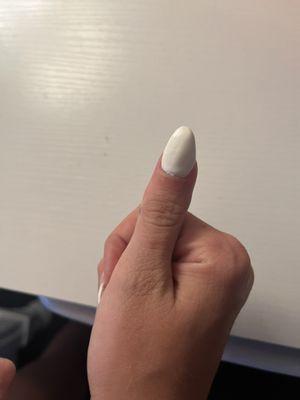 Bad nails