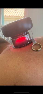 infrared red cupping