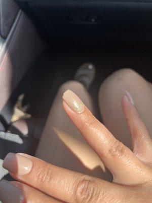 Chipped nails