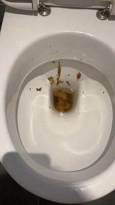 The excrement he left in my toilet.