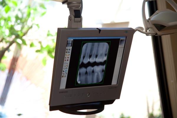 Digital xrays allow for better discussion of your mouth.