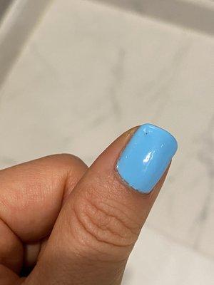 Bubble in my nail