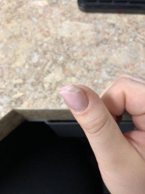 nail peeling