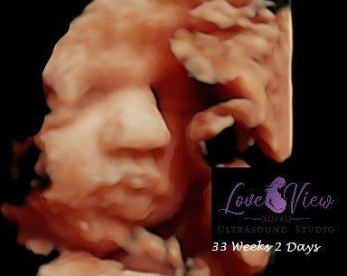 Love View 3d 4d ultrasound studio