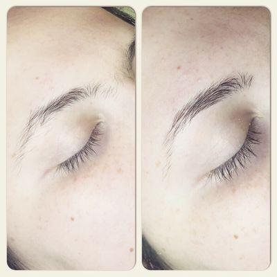 Before and after: brow sculpting.