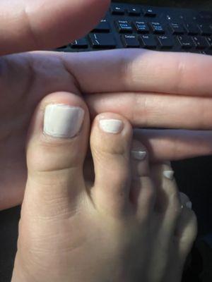 Horrible pedicure I got yesterday