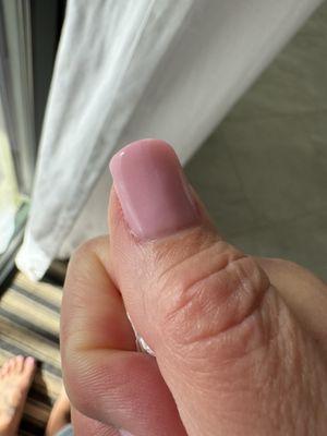 Product clumped on sides of cuticles