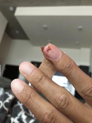 Split ring finger nail while removing acrylics