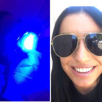 Laser Teeth Whitening promotion - only at Albany County Dental Associates ! Results are amazing!