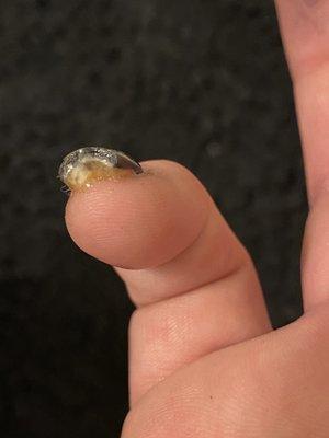 Lifted nail due to stylist filing down too far and infected