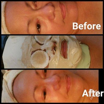 4 Layer Facial!