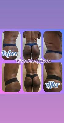 Click the link to book your Free Consultation !!!  https://blessedbodycurvesscheduling.as.me/