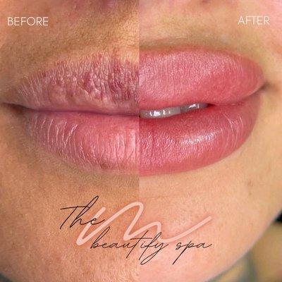 Lip Blush Before & After