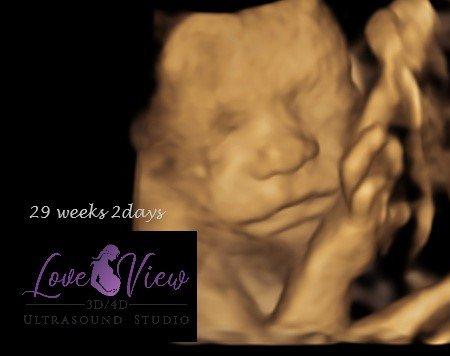 Love View 3d 4d ultrasound studio