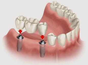 Soft Touch Dental Care