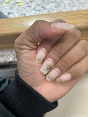 THE MAN RUSHED JUST TO GIVE FUNGUS UNDERNEATH MY ACRYLIC!!!!