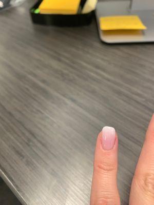 Uneven pinky