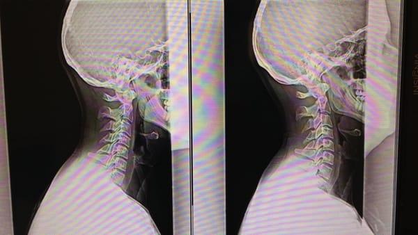 Here is some of the before and after results from care provided to a patient in the office